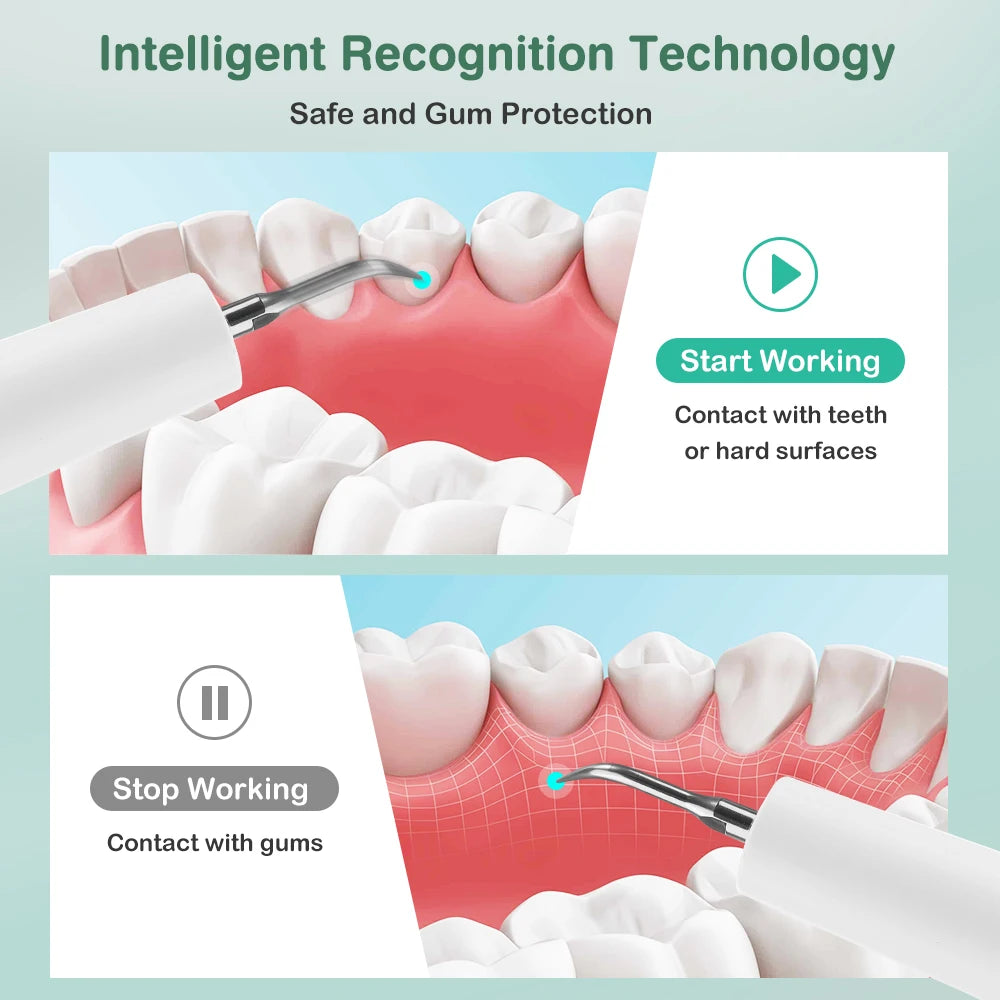 Intelligent Ultrasonic Dental Scaler Teeth Tartar Remover 5 Modes